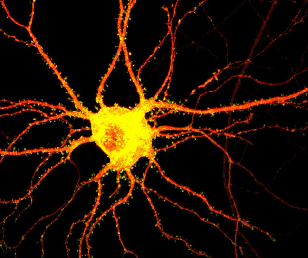 ●文献解析|Nature—单细胞RNA-seq揭示年龄相关脑功能衰退机制